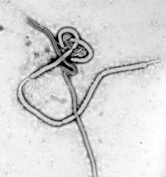 Imagen real del virus ébola mediante microscopía electrónica